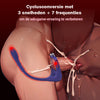 Lord of the Rings 10 vibrerende anale stimulator met cockring